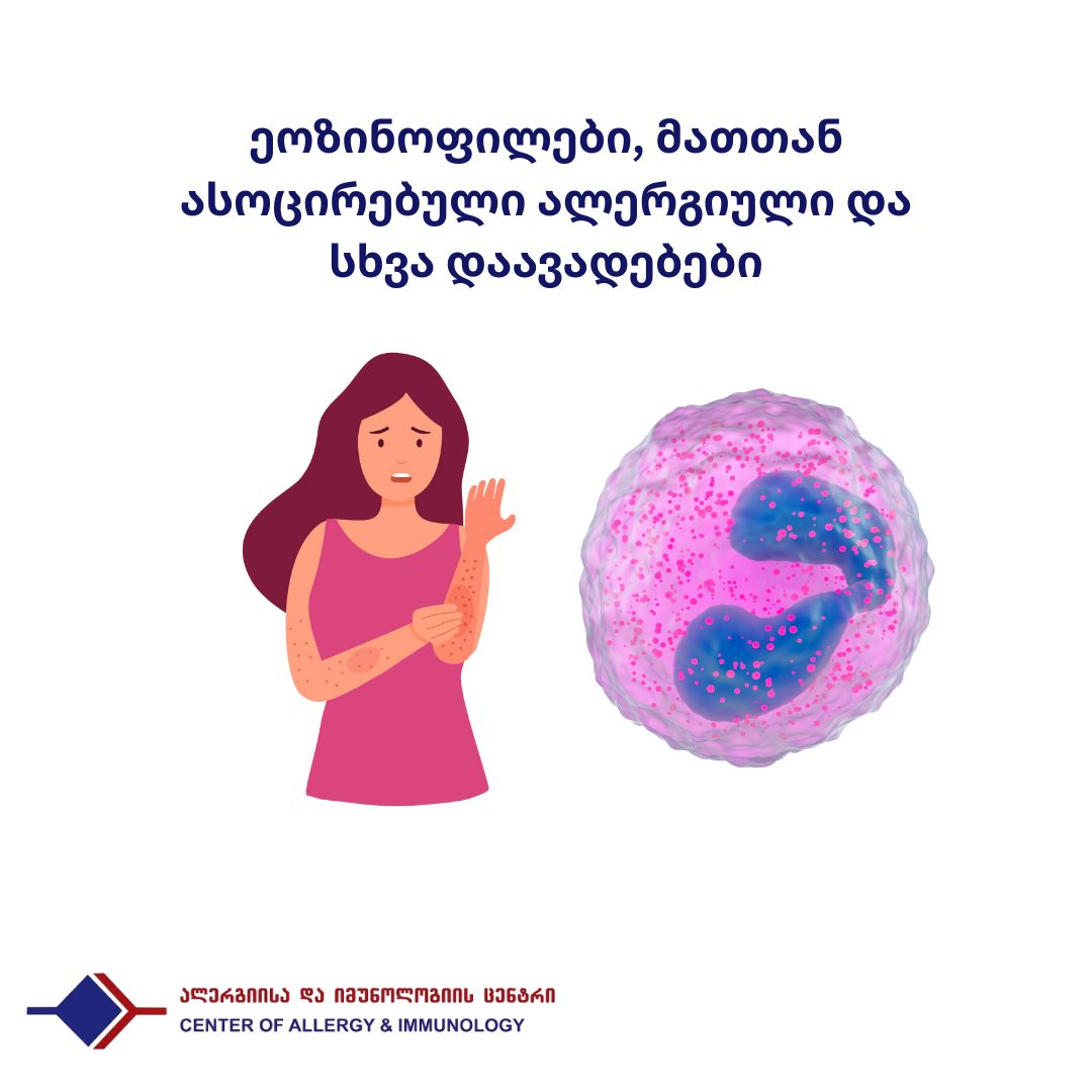 ეოზინოფილები, მათთან ასოცირებული ალერგიული და სხვა დაავადებები