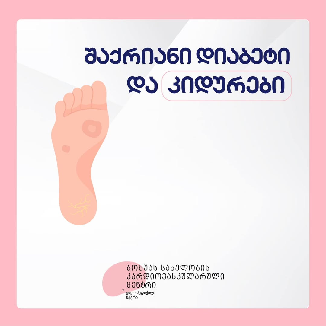 შაქრიანი დიაბეტი და კიდურები