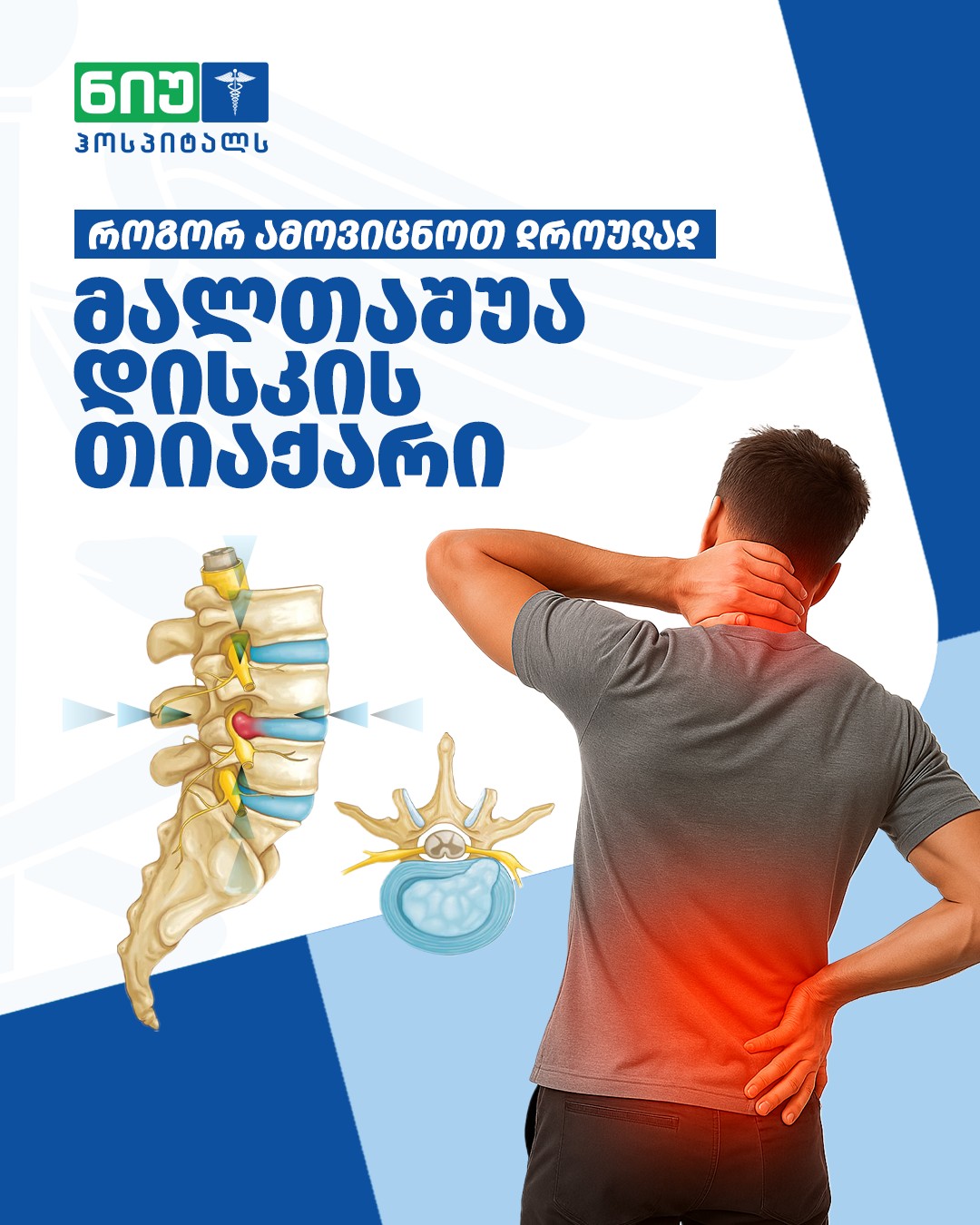 როგორ ამოვიცნოთ დროულად მალთაშუა დისკის თიაქარი?