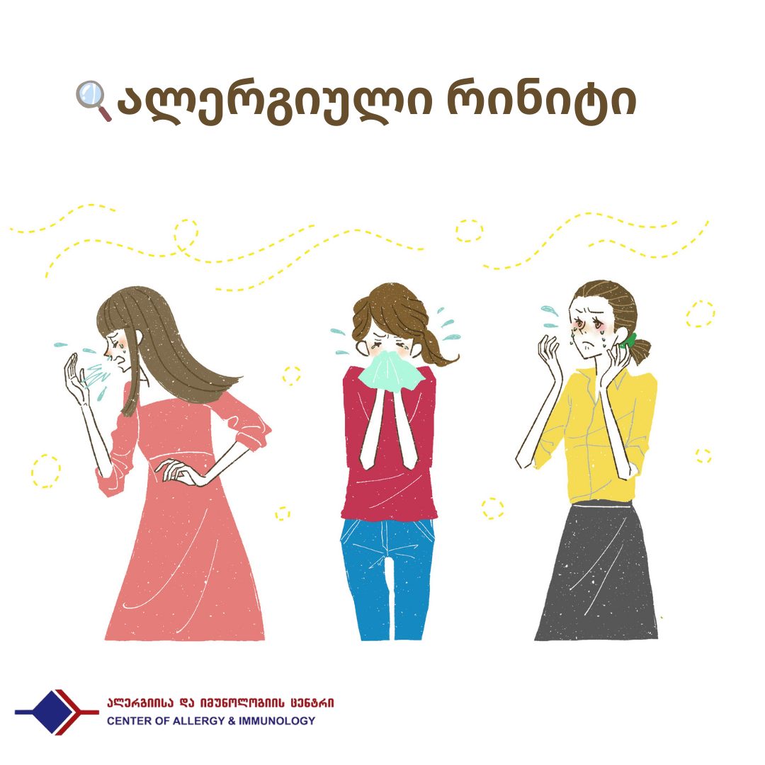 ალერგიული რინიტი