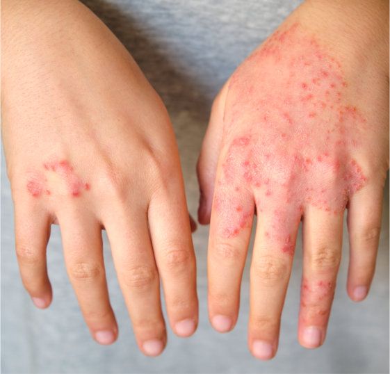 ხშირად დასმული შეკითხვები მუნთან დაკავშირებით