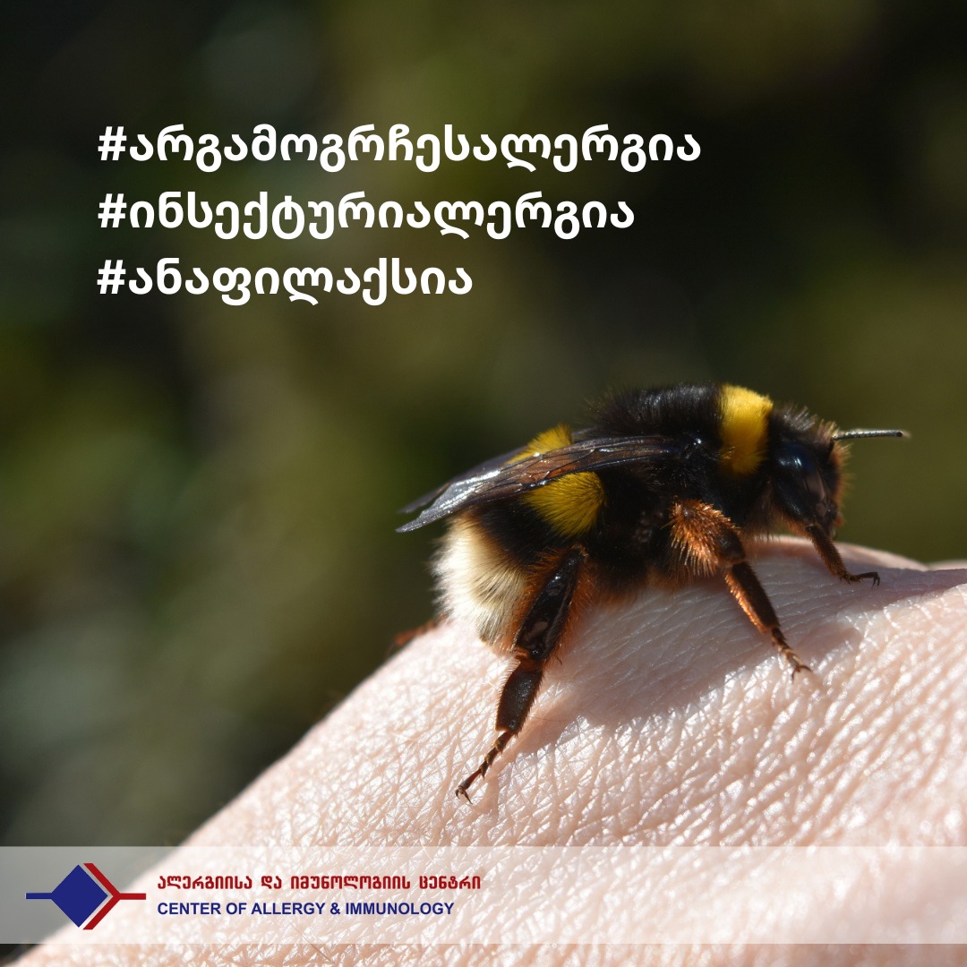 მწერის ნაკბენზე განვითარებული ალერგიული რეაქცია