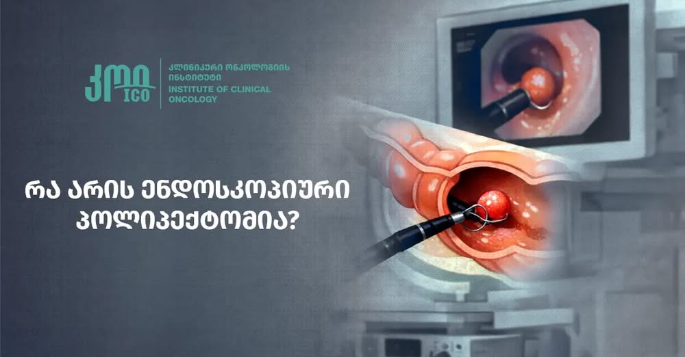 რა არის ენდოსკოპიური პოლიპექტომია?