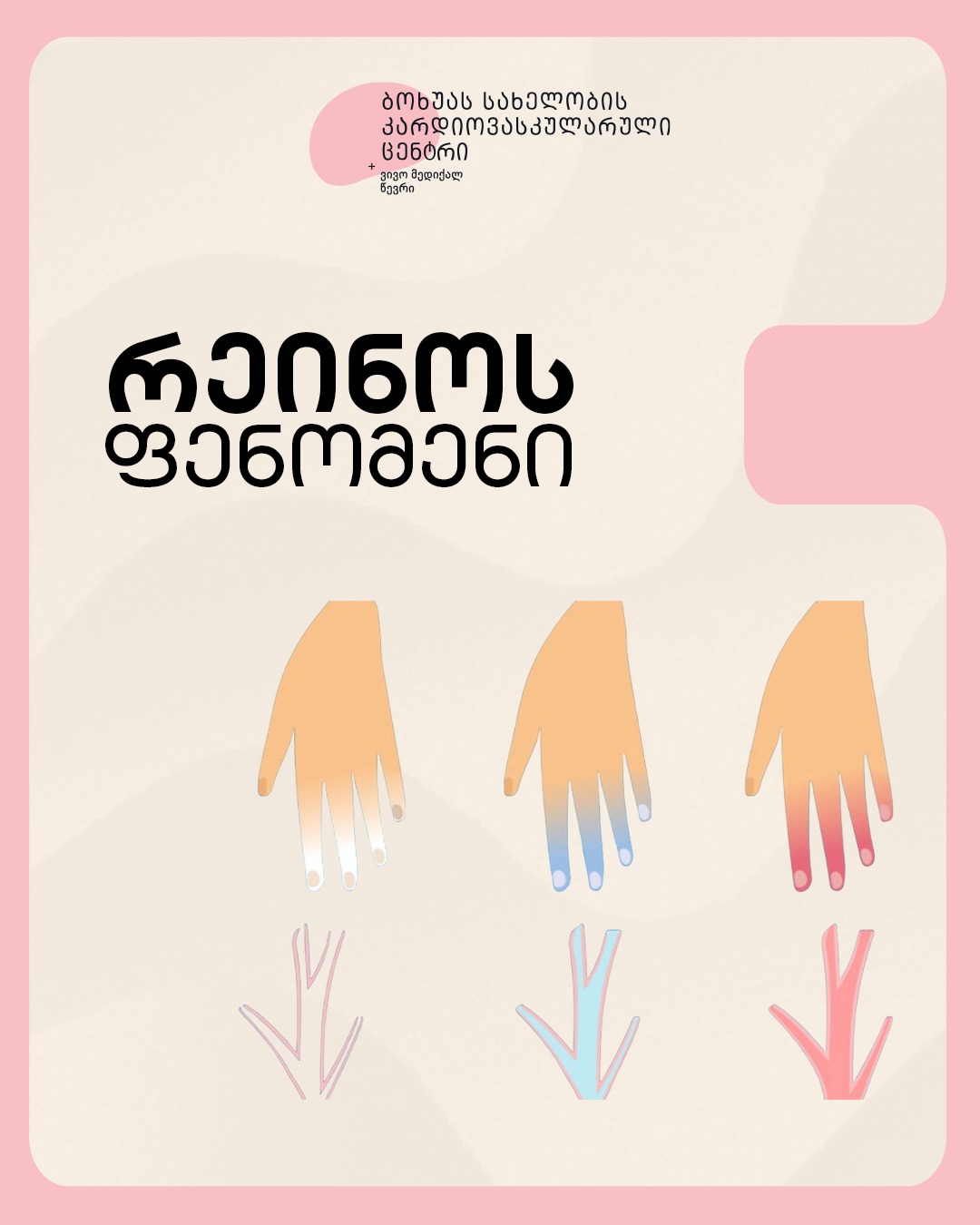 რა არის რეინოს ფენომენი?